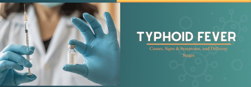Typhoid Fever